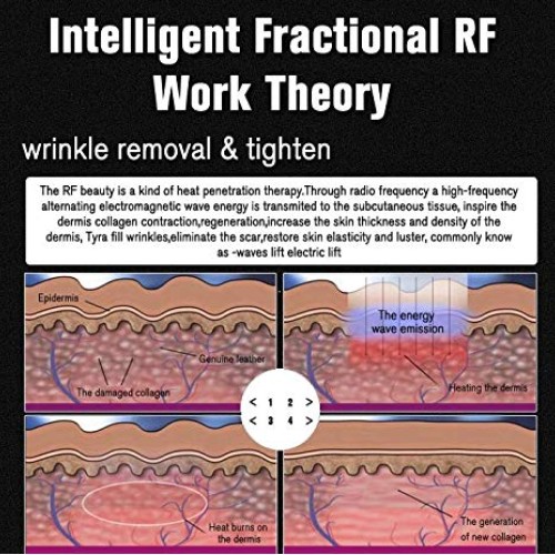 Portable RF fractional Machine face Tightening rejuvenate