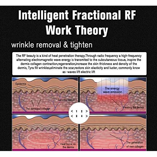 Portable RF fractional Machine face Tightening rejuvenate