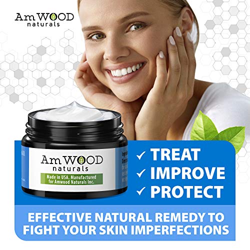 Acne Spot Treatment Cream - Made in USA - Fast-Acting Formula for...