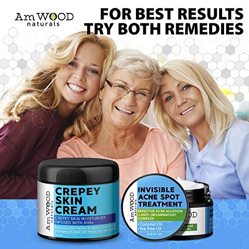 Acne Spot Treatment Cream - Made in USA - Fast-Acting Formula for...