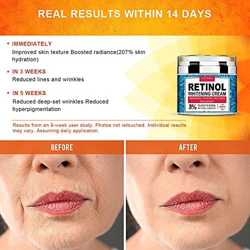 Retinol Moisturizer Cream for Face, Neck and Décolletage with Col...