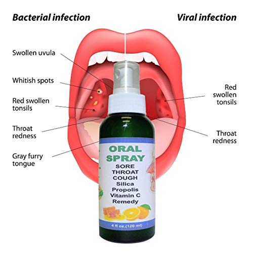 Sore Throat ANTIVIRAL Cough Oral Spray Silica Vitamin C & Bee Pro...