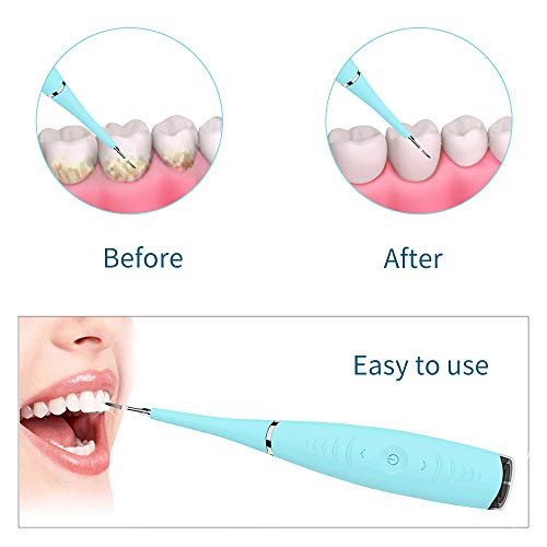 Electric Dental Calculus Plaque Remover Tooth Scraper Tartar Remo...