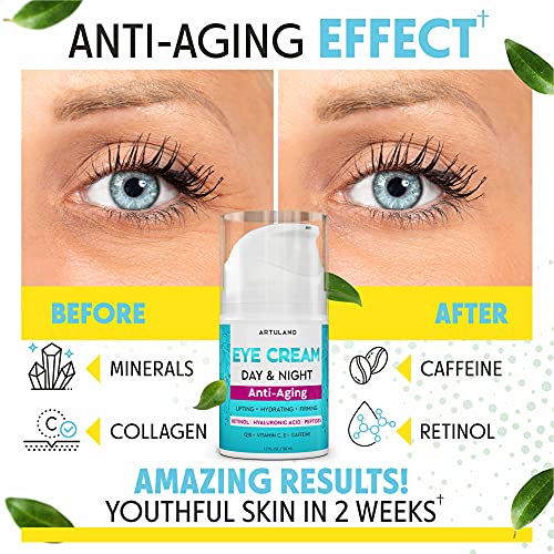 Under Eye Cream Serum For Dark Circles and Puffiness - with Hyalu...