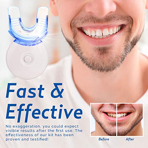 AsaVea Teeth Whitening Kit - Advanced Teeth Whitening System with...