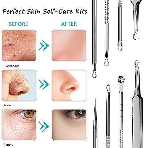 Blackhead Remover Face Mask,Black Mask,3-in-1 Purifying Charcoal ...