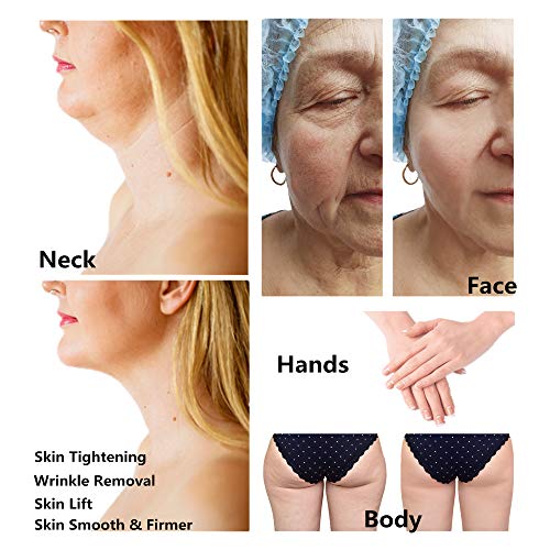 Avorla High Frequency Device- Anti Aging Skin Tightening- Wrinkle...