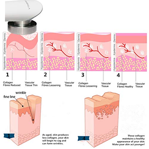 Avorla High Frequency Device- Anti Aging Skin Tightening- Wrinkle...