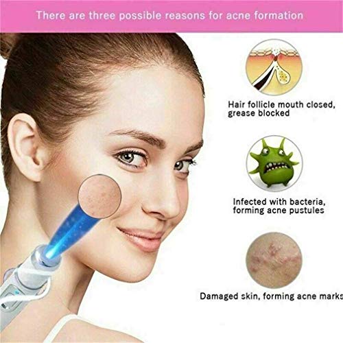 New Blue Light Therapy Varicose Veins Pen - Soft Scar Wrinkle Rem...