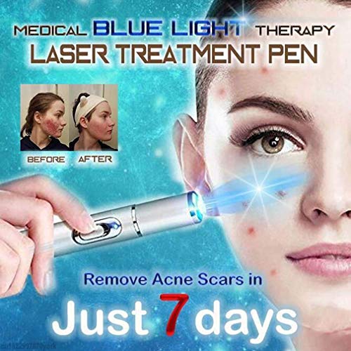 New Blue Light Therapy Varicose Veins Pen - Soft Scar Wrinkle Rem...