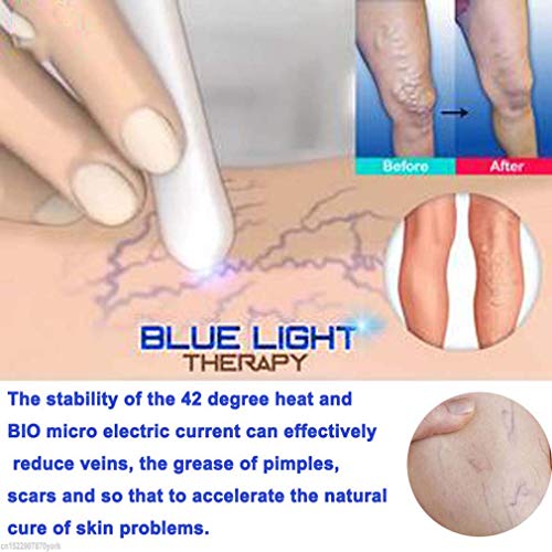 New Blue Light Therapy Varicose Veins Pen - Soft Scar Wrinkle Rem...