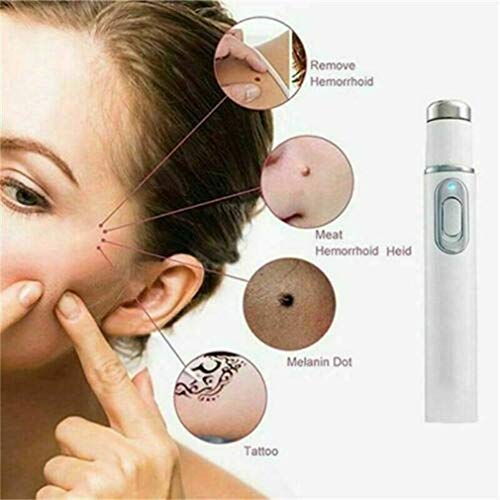New Blue Light Therapy Varicose Veins Pen - Soft Scar Wrinkle Rem...