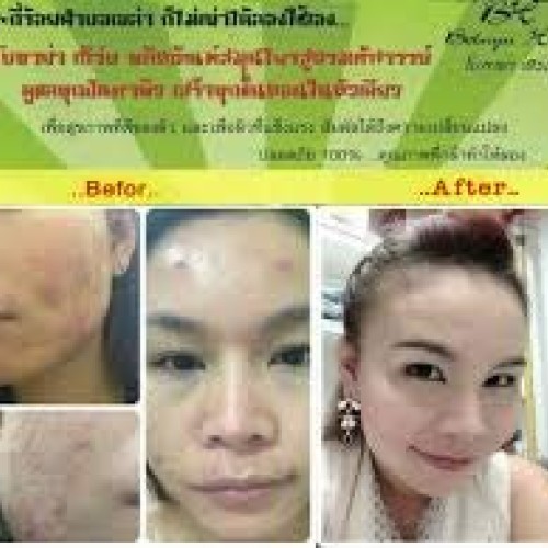 Botaya. Herb โบทาย่า เฮิร์บ Tinospora Serum Booster Skin Care Ski...