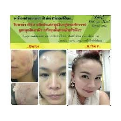 Botaya. Herb โบทาย่า เฮิร์บ Tinospora Serum Booster Skin Care Ski...