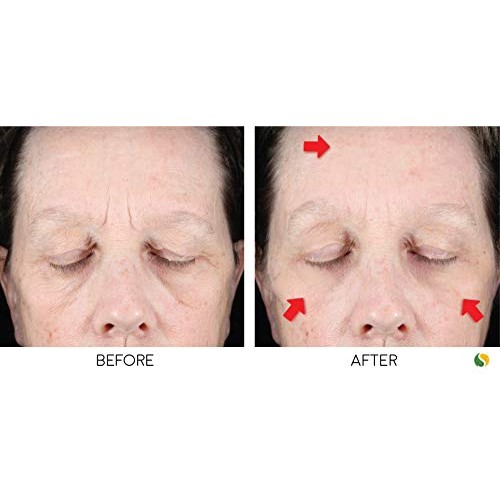 Bratoxinsta Instant Anti-Wrinkle Skin Lifting Botox Serum Saggy S...