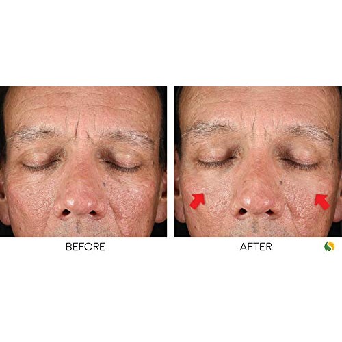 Bratoxinsta Instant Anti-Wrinkle Skin Lifting Botox Serum Saggy S...