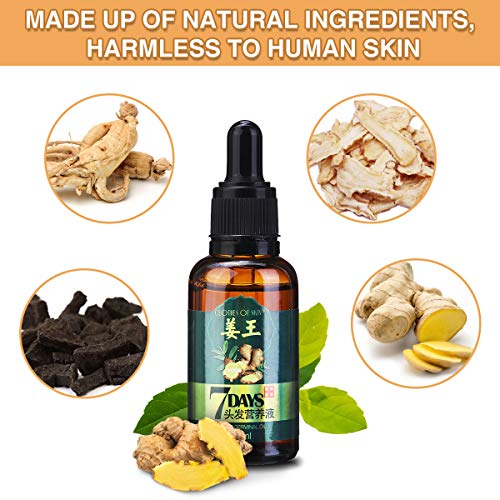 CHARMINER Ginger Germinal Oil, 3 PCS Ginger Hair Growth Oil, Gi...
