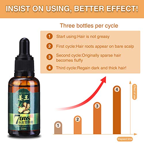 CHARMINER Ginger Germinal Oil, 3 PCS Ginger Hair Growth Oil, Gi...