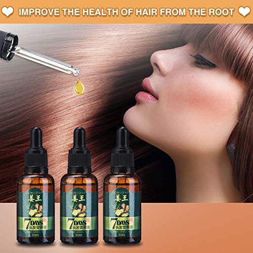 CHARMINER Ginger Germinal Oil, 3 PCS Ginger Hair Growth Oil, Gi...
