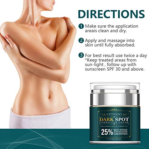 Intimate Areas Cream for Women, Dark Spot Remover Cream for Intim...