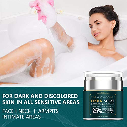 Intimate Areas Cream for Women, Dark Spot Remover Cream for Intim...