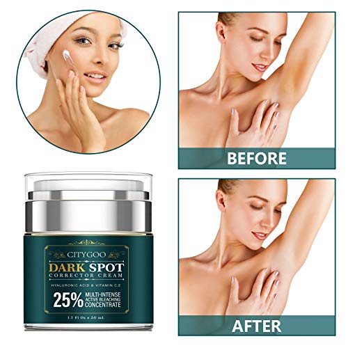 Intimate Areas Cream for Women, Dark Spot Remover Cream for Intim...