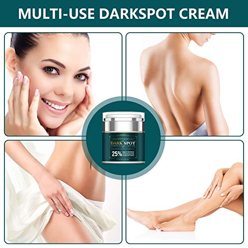 Intimate Areas Cream for Women, Dark Spot Remover Cream for Intim...