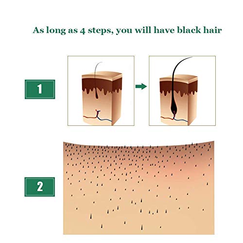 Ginger Germinal Oil,2020 Hair Growth Ginger Essential Oil Hair Gr...