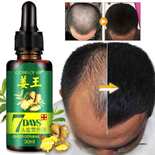 Ginger Germinal Oil 3 PACK,2020 Hair Growth Ginger Essential Oil ...