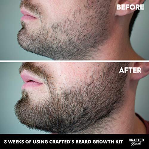 Beard Growth Oil 2 pack - Crafted’s Beard Growth Serum - Help Fil...