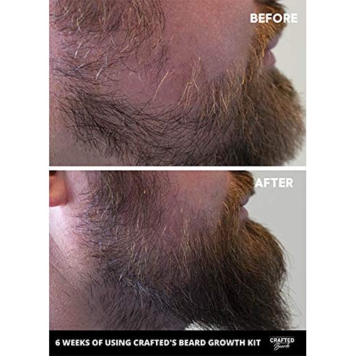 Beard Growth Oil 2 pack - Crafted’s Beard Growth Serum - Help Fil...