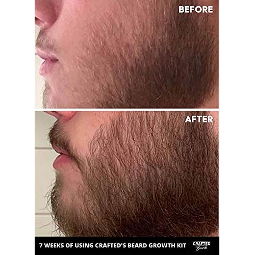Beard Growth Oil 2 pack - Crafted’s Beard Growth Serum - Help Fil...