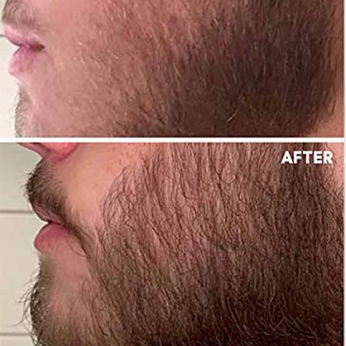 Beard Growth Oil 2 pack - Crafted’s Beard Growth Serum - Help Fil...