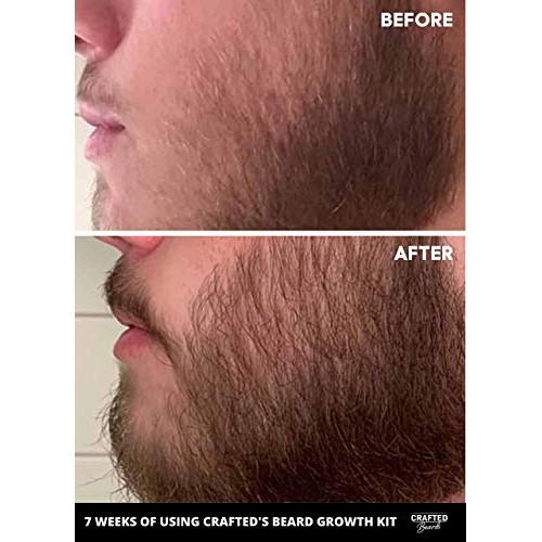 Beard Growth Oil - Crafted’s Beard Growth Serum - Help Fill in Pa...