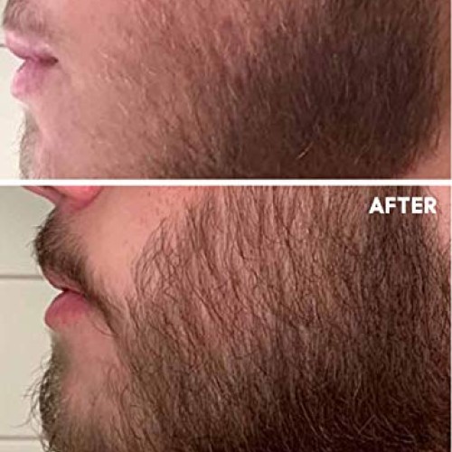 Beard Growth Oil - Crafted’s Beard Growth Serum - Help Fill in Pa...