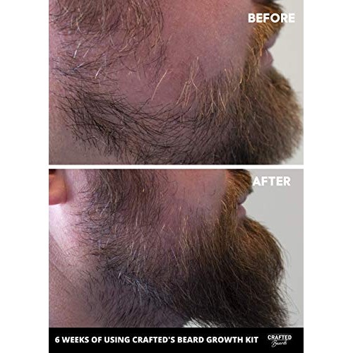 Beard Growth Oil - Crafted’s Beard Growth Serum - Help Fill in Pa...