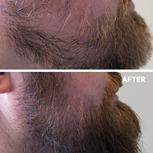 Beard Growth Oil - Crafted’s Beard Growth Serum - Help Fill in Pa...
