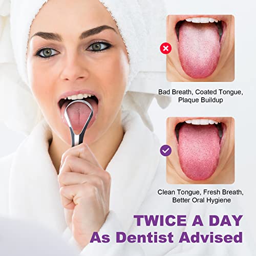 D Tongue Scraper, Stainless Steel Tongue Cleaners with Travel Cas...