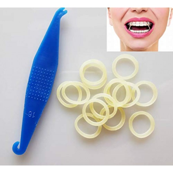 100 Pcs DentalSmile Amber 1/4 Elastic Rubber Bands Latex Braces 3.5oz  MediumDental Orthodontic Latex Bands Dentist Great for Dreadlocks, Braids,  Top