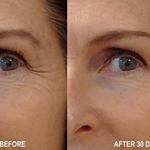 Magic Collagen Booster-Time Reversing Serum with Argireline, Matr...