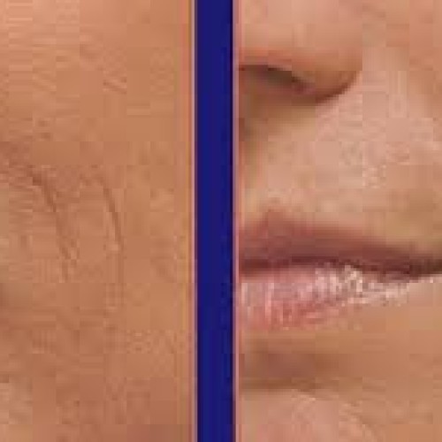 Magic Collagen Booster-Time Reversing Serum with Argireline, Matr...