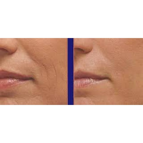Magic Collagen Booster-Time Reversing Serum with Argireline, Matr...