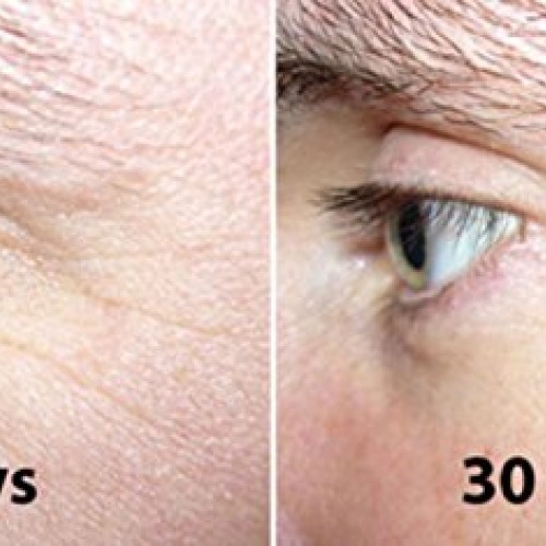Magic Collagen Booster-Time Reversing Serum with Argireline, Matr...