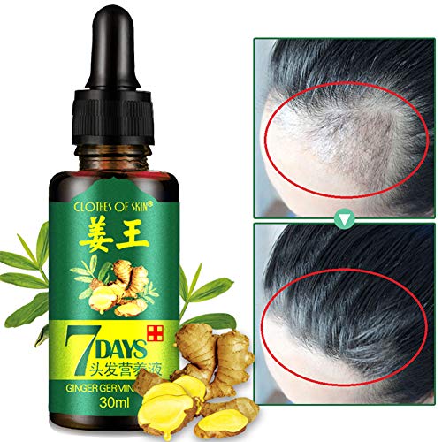 DXR Ginger Germinal Oil,Hair Growth Serum,2020 Hair Growth Ginger...