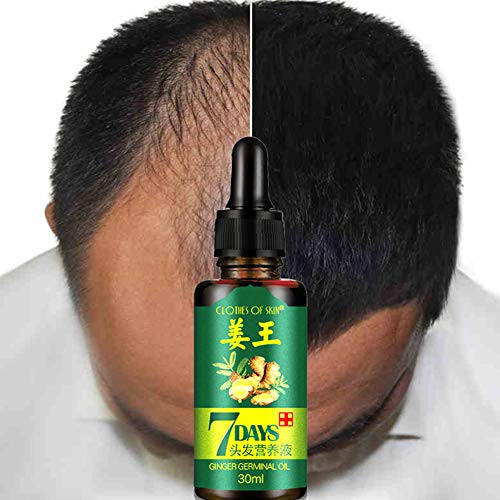 DXR Ginger Germinal Oil,Hair Growth Serum,2020 Hair Growth Ginger...