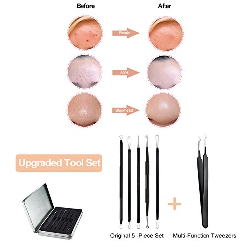 Ellesye Blackhead Remover,6 PCS Pimple Popper Tool with a Metal S...