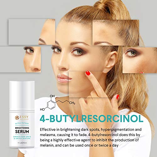 EssyNaturals Dark Spot Corrector Remover for Face, Treating Melas...