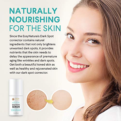 EssyNaturals Dark Spot Corrector Remover for Face, Treating Melas...