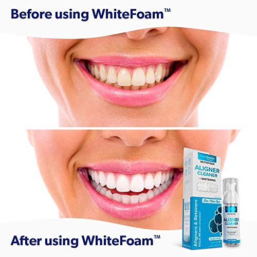 EverSmile WhiteFoam & OrthoChew Value Pack | On-the-Go Clear Reta...