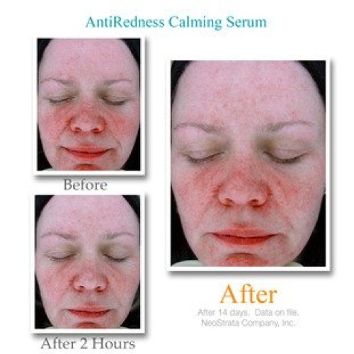 Exuviance Anti Redness Calming Serum, 1.0 Ounce
